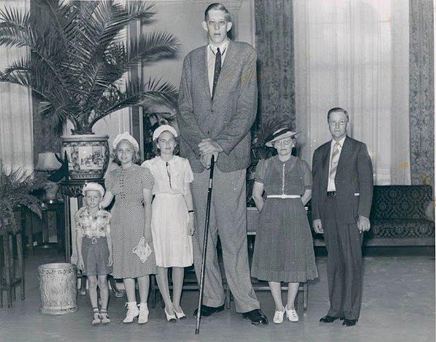 2. Karşınızda tarihe adını dünyanın en uzun boylu insanı olarak geçirmiş olan Robert Wadlow. Bilinen adıyla 'Dev Alton' 1918 Amerika doğumlu. Wadlow, 22 yaşında öldüğünde 272 cm boyunda ve 199 kg ağırlığındaydı. Tarihte kayıtlara geçen daha uzun boylu biri olmadığı için, Wadlow gelmiş geçmiş en uzun insan olarak biliniyor.