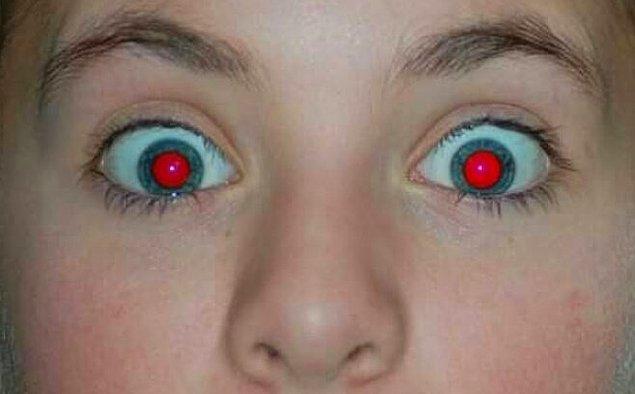 14. "Fotoğraflarda gözleriniz kırmızı çıkabilir çünkü göz bebeğiniz sadece bir deliktir. Flaş gözlerinizin arkasındaki kan damarlarını yansıtır."