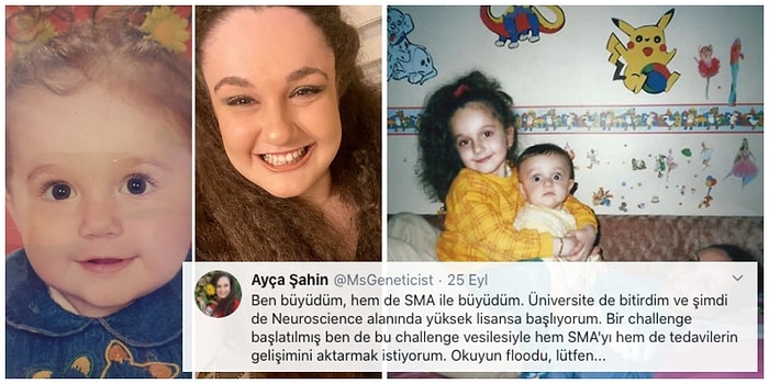 SMA ile Büyüdü! Üniversite Öğrencisi Ayça'nın Yaşadıklarını ve Tedavinin Önemini Anlattığı Farkındalık Yaratan Paylaşımı