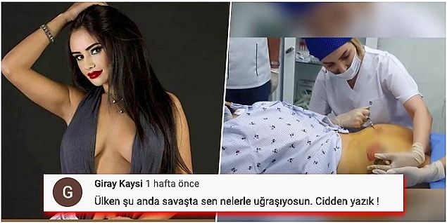 1. Poposuna estetik yaptırdığı anları sansürsüz bir şekilde paylaşan ünlü gelin adayı Naz Mila, eleştirilerin hedefi oldu!