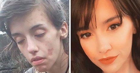 «Дневник наркомана»: 20 невероятных историй о том, как люди бросили наркотики