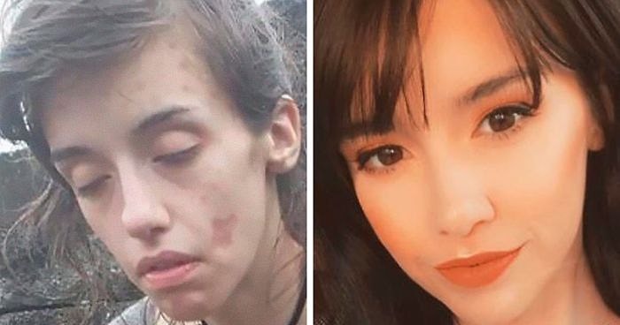 «Дневник наркомана»: 20 невероятных историй о том, как люди бросили наркотики