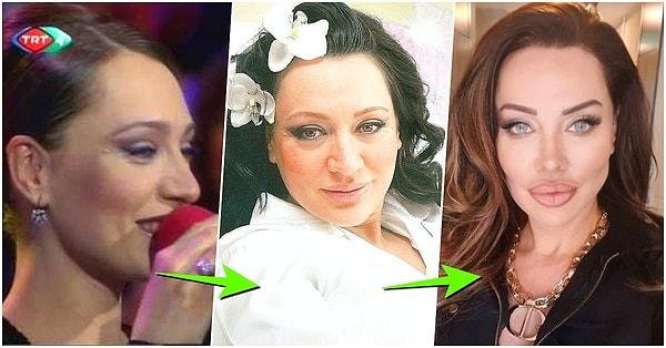 1. Yaptırdığı estetiklerle Angelina Jolie'nin ikizi haline gelen Umut Akyürek, değişimiyle herkesi şaşırttı!