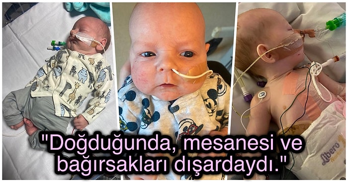 Karın Ağrısından Dolayı Apandisit Şüphesiyle Çağırdığı Ambulansta Doğum Yaparken Hamile Olduğunu Öğrenen Kadın