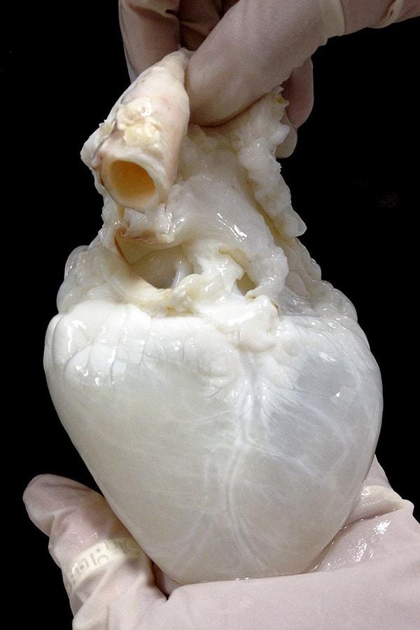15. Temizlenmiş bir kalbin görüntüsü.