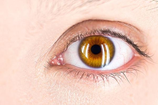 1. "Gözümün tamamen kırmızı olduğu bir rahatsızlığım vardı ve hemşirenin biri sağlam gözüme bakıp 'Çok güzel retinaların var' demişti. Teşekkür ederim?"