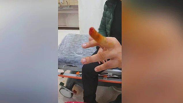 7. Hastanede olay çıkaran hasta yakınının güvenlik görevlisinin parmağını ısırarak koparması...