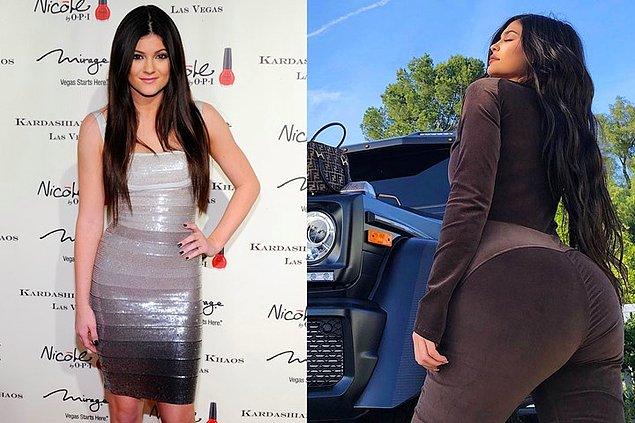 Kylie Jenner'ın kalça bölgesindeki değişim
