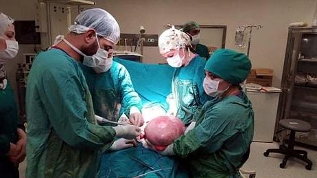 Ağrım Var Diye Hastaneye Gitmişti: Genç Kızın Karnından 9 Kilo 800 Gramlık Kitle Çıkarıldı