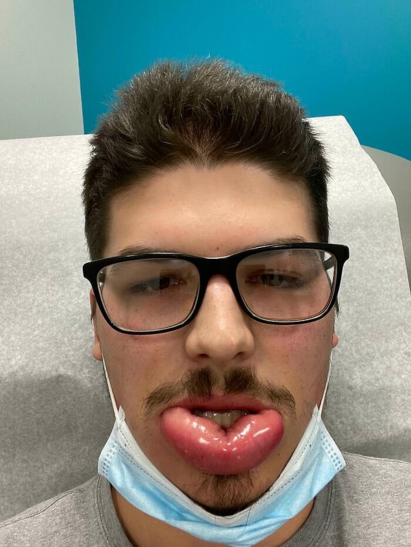 12. Укусила за губу оса. 2020 год, конечно, был интересным