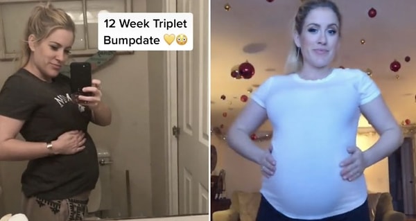 «Около 10% женщин могут овулировать дважды в месяц, но только 3% могут оказаться в такой же ситуацию, как я».