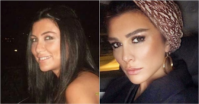 Söz konusu fotoğraflarındaki değişimi ise doğru açı ve ışıkla açıklamıştı...