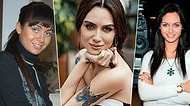 Yıllar Onu Çok Değiştirmiş! Estetik ile Adeta Evrim Geçiren Birce Akalay'ın İlginç Serüveni