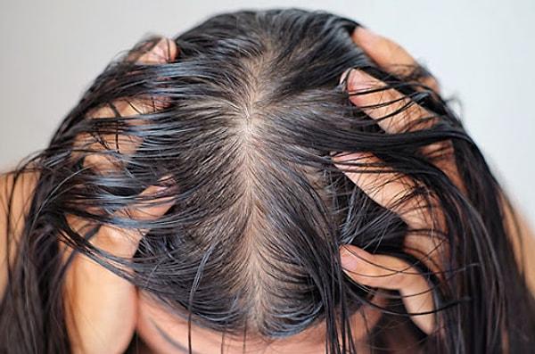 1. Yağlı Saçlar: Saçınızı yıkadıktan sadece 1 gün sonra bu şekilde görünüyorsa bu bölüm tam size göre.