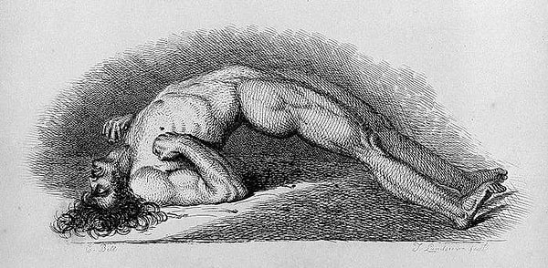 9. Судороги, которые может испытывать тело после смерти, в средние века часто считались демонами, которые, якобы, обладали человеческими телами, но не воскрешались полностью.