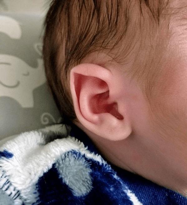 3. "Oğlumun doğuştan elf kulakları var!"