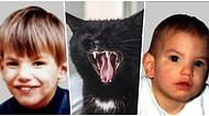 Çocukların Kedi Gibi Miyavlamasına Neden Olan Genetik Hastalık: ‘Cri Du Chat Sendromu’
