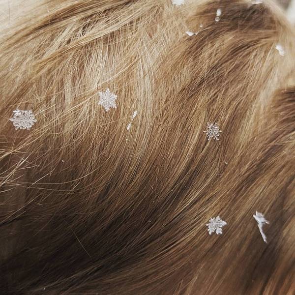 7. "Узорчатые снежинки в волосах моего сына".