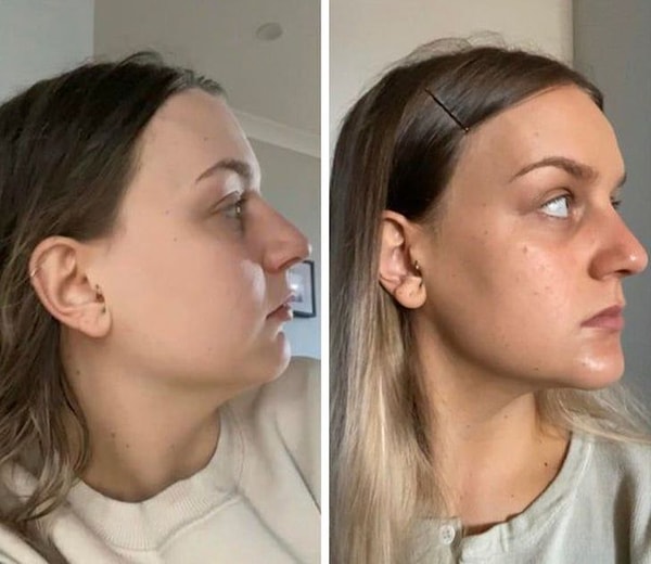 9. «8 недель назад и сейчас».