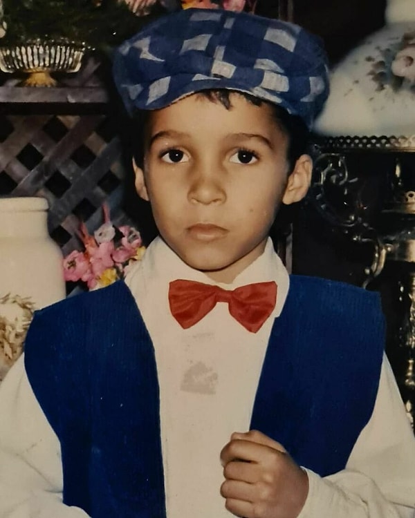 В детстве Роджер не страдал витилиго; оно развилось только в возрасте 23 лет