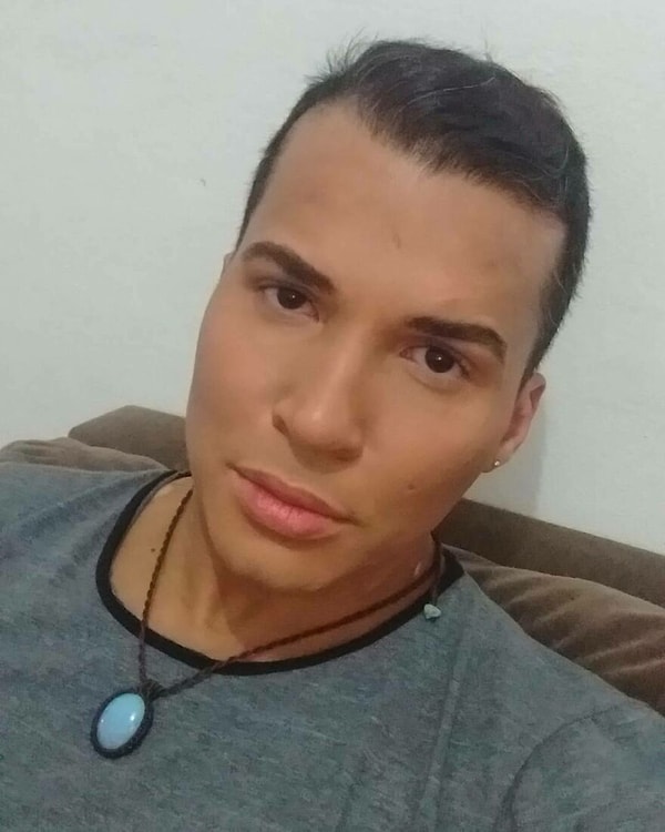 Он обычно закрывал свои белые пятна толстым слоем макияжа, чтобы скрыть свою болезнь от мира, не посещал пляжи и тренажерные залы.