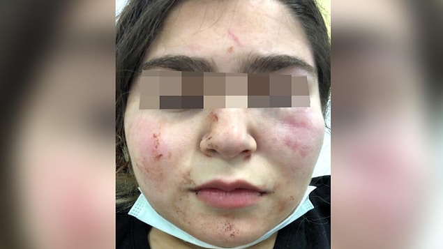 Polisin 3 Şubat'ta basit bir olay yüzünden kızına ve kendisine orantısız şiddet uyguladığını söyleyen Başöngen, şöyle devam etti: