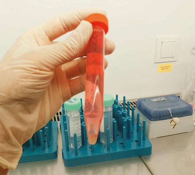 ABD'de patent başvurusu yapıldı