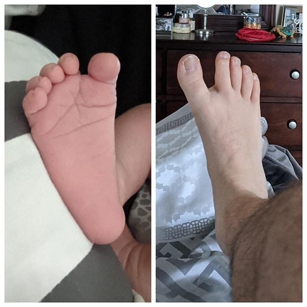 18. "Karım yeni doğum yaptı, oğlum ve ben aynı tuhaf genetik anormalliğe sahibiz. Ayak başparmaklarımız ile diğer parmaklarımız arasında çok büyük bir boşluk var."