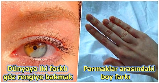 Keşfettikleri Eşsiz Özellikleri Sayesinde İnsan Bedeninin Ne Kadar Büyüleyici Olduğunu Kanıtlayan 21 Kişi