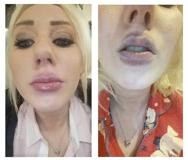 Ayrıca içeriğindeki dolgu malzemesinin ne olduğu da bilinmiyor.