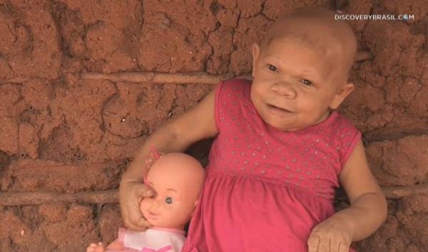 Maria Audete do Nascimento, Brazilya'nın bir köyünde yaşamını sürdüren 1981 doğumlu bir kadın. O, inanması güç olsa da 2 yaşındaki bir bebeğin vücuduna ve zihnine hapsolmuş durumda.