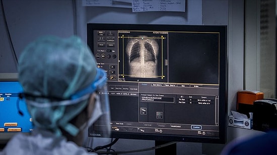 Koronavirüs: 157 Can Kaybı Var, Vaka Sayısı 30 Bine Dayandı!