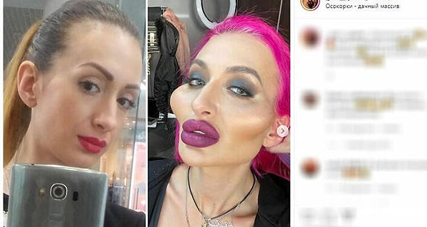 Женщина, которая много раз лежала на операционном столе, признается, что потратила тысячи долларов, чтобы стать обладательницей такой внешности.