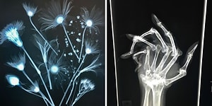 20 раз, когда люди cделали рентгеновские снимки и получили интересные результаты