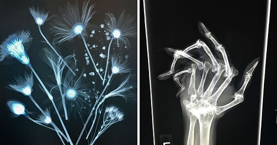 20 раз, когда люди cделали рентгеновские снимки и получили интересные результаты