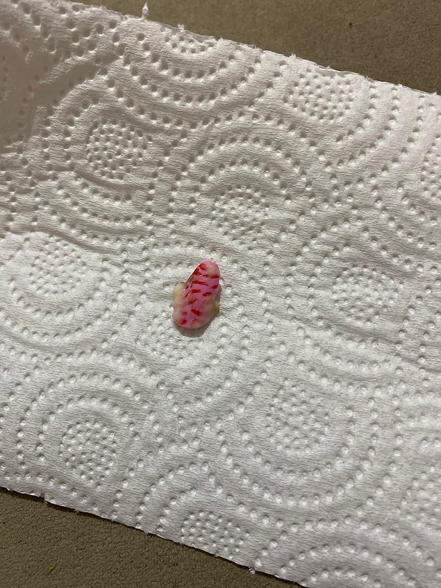İşte bu da o tırnak! Ama gördüğünüz gibi nail art yapılmış ve son dönem moda olan protez tırnaklardan bir tanesi.