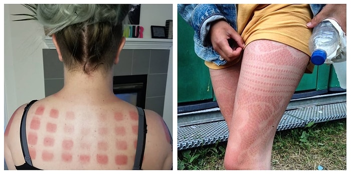 8 антипричин не пользоваться средством защиты от солнца (ведь эта штука - для слабаков, да? :)