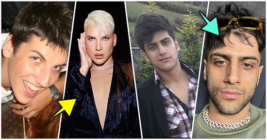 Sosyal Medyaya Adım Attıktan Sonra Değişime Kafa Atarak Eski Hallerinden Eser Kalmayan Erkek Influencerlar