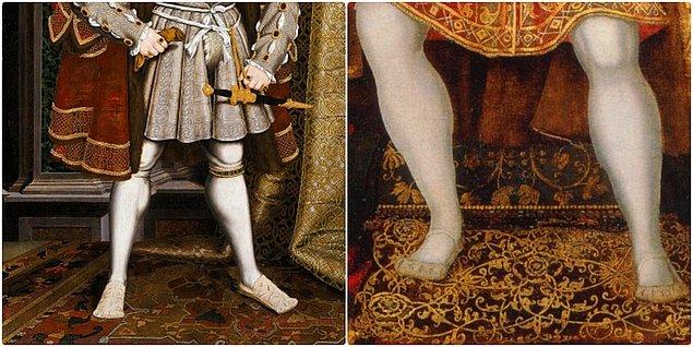 Henry VIII – Bacak ülserini saklayacağım derken öldü.