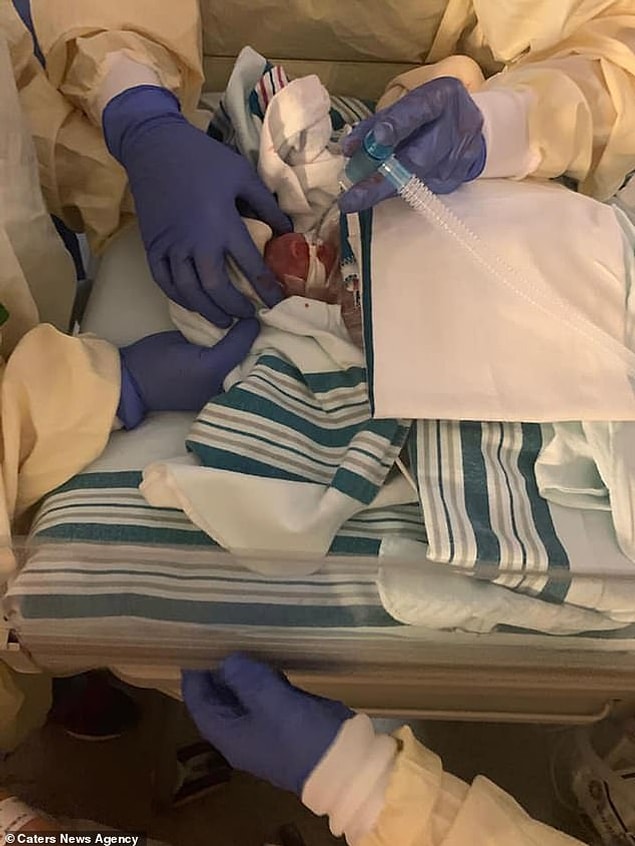 Declan 652 gram, Rowan 481 gram ve minik Cian doğduğunda sadece 453.5 gramdı.