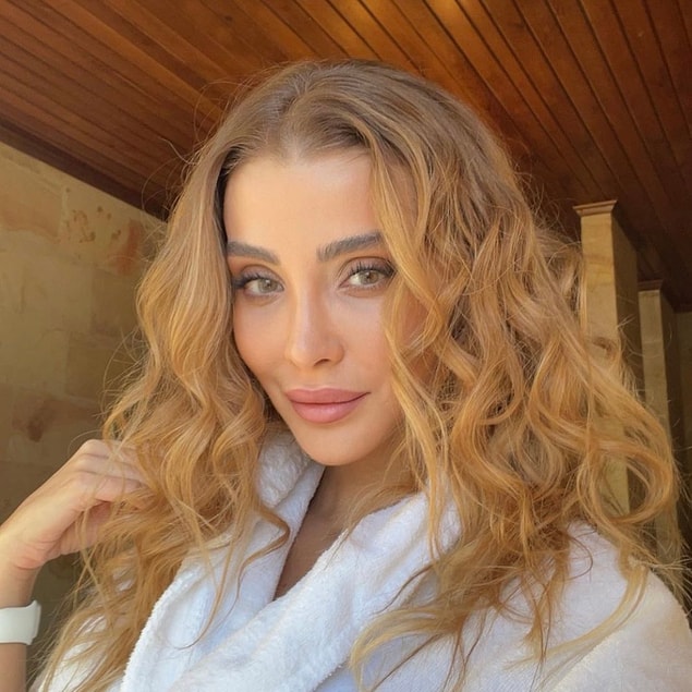 15. Özge Ulusoy, ilk estetik ameliyatını yaptırdığını söyleyerek son halini paylaştı.