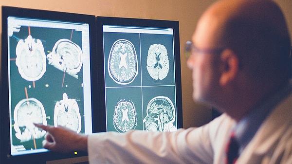 Alzheimer’da erken teşhis ne kadar önemli?