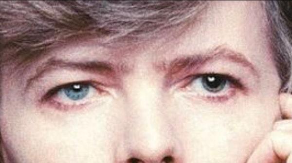 11. David Bowie'nin tek gözünün bebeği kalıcı olarak irileşmiş.