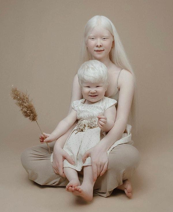 Albinizmli kız kardeşlere moda dünyasından ilgi yoğun