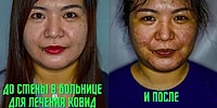10 удивительных снимков в стиле "до и после", которые заставят вас глубоко вздохнуть