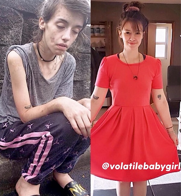 7. До и после выздоровления от наркотической зависимости: