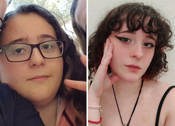 13. 17 и 20 лет. Теперь я счастливее и здоровее. Не могу поверить, что это была я