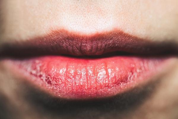 12. Kupkuru, çatlak dudaklarınız varsa onlara da gerekli bakımı yaparak, daha genç ve sağlıklı bir görünüme kavuşturabilirsiniz.