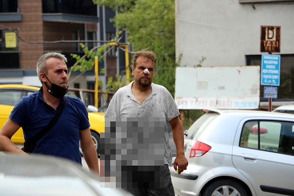 Zonguldak'ta şu ana kadar en az 12 kişi hastaneye başvurdu. Bir vatandaşın kesim sırasında parmağı koptu.