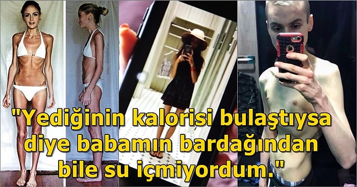 Anoreksiya Hastası Genç Kızın 28 Kiloya Düştükten Sonra Ölümden Dönüş Hikayesi Tüylerinizi Diken Diken Edecek!